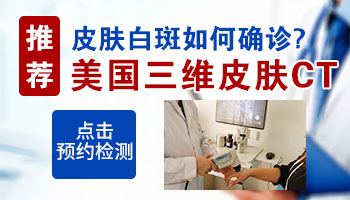 女性胸前有点白是得了白癜风吗