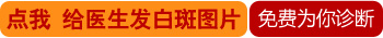 三甲医院有没有检查白癜风的伍德灯仪器