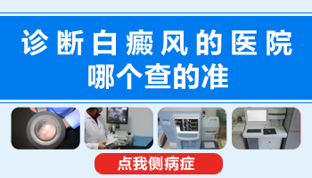 如果有白癜风测微量元素能查出来吗