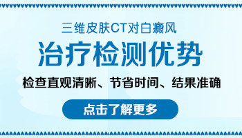 伍德灯能不能查白癜风黑色素脱失了多少