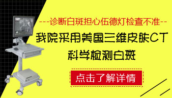 伍德灯能不能查白癜风黑色素脱失了多少