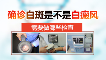 手掌上的小白点是什么 检查白斑做哪些检查