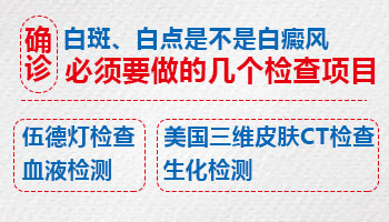 孩子脑门有一白斑怎样确诊是不是白癜风