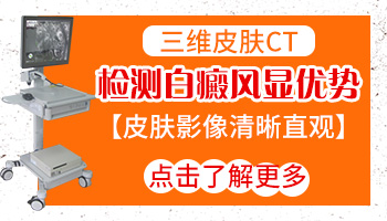 受伤留下的白斑照伍德灯亮白色是白癜风吗