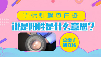 伍德灯检查显示阳性是白癜风吗