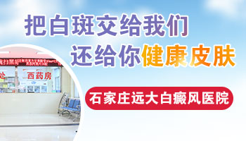 白癜风在伍德灯下的颜色