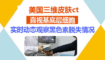 三维皮肤ct检查多少钱一次 ct能确定白斑类型吗