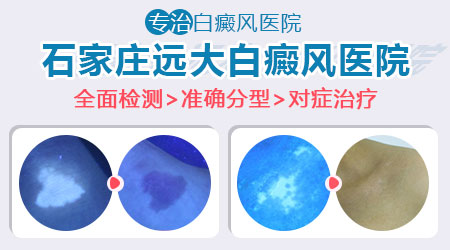 新生儿大腿根发白是得了什么病