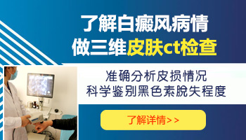 确诊白癜风就靠伍德灯的照射就可以看出来