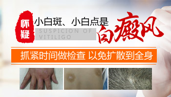 身上长了白斑去医院做什么检查