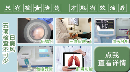 检查白斑方法有哪些 确诊白斑要做的检查项目