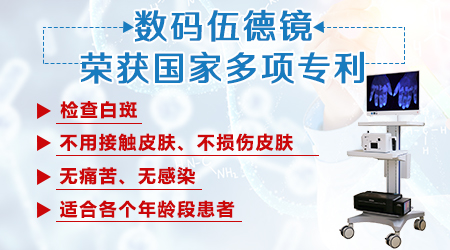 数码伍德灯检查白斑一次多少钱 伍德镜下白癜风图片