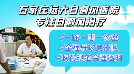 肉眼如何判断白斑是不是白癜风