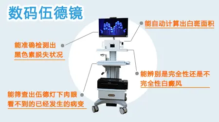 伍德镜检查白斑一次多少钱