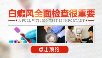 伍德镜检查白斑一次多少钱