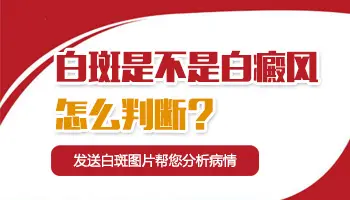 怎么判断是不是白癜风 鉴别白斑做哪些检查