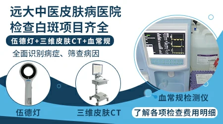 宝宝白斑是不是白癜风 白斑做什么检查