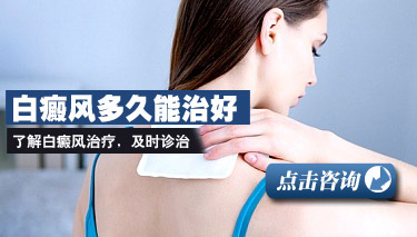 儿童白癜风症状有什么特性