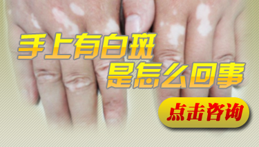 关于儿童白癜风发病初期的症状你能否了解