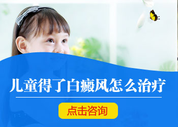 白癜风有什么清楚症状