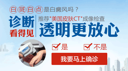 腿上有一块白是白癜风吗
