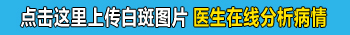 7岁宝宝外阴周边白一片是白癜风吗