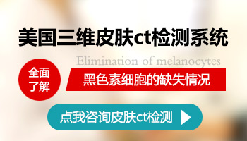 胳膊上长白点是不是白癜风