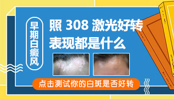 308激光后有白斑变红了有点没变红是什么情况