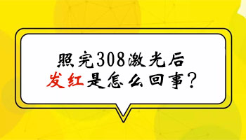 照完308激光白癜风部位应该发红吗