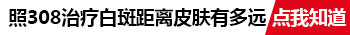 照完308激光白癜风部位应该发红吗