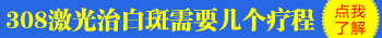 头皮轻度白癜风图片