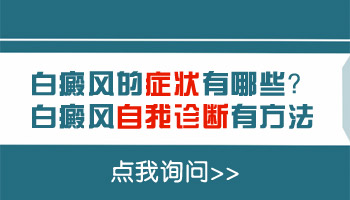 邯郸白癜风主要症状有哪些