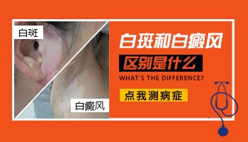 特发性白斑与白癜风区别