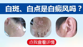 腰部和大腿内侧出现白点是什么