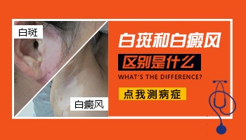 白斑病与白癜风的区别是什么呢