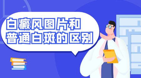 白癜风和白斑的区别图片