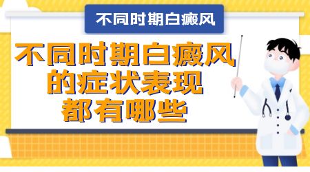 白癜风会起皮吗 初期白癜风症状