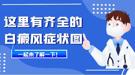 白癜风病发的症状表现都有哪些