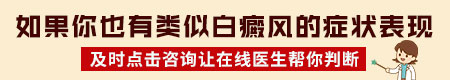 轻度白癜风症状表现都有哪些