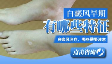 女性患上白癜风应该怎么做