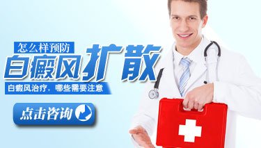 白癜风的症状表现特点