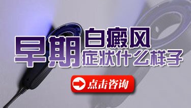 青少年头部白癜风症状