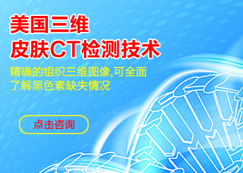 治疗女性白癜风什么方法好