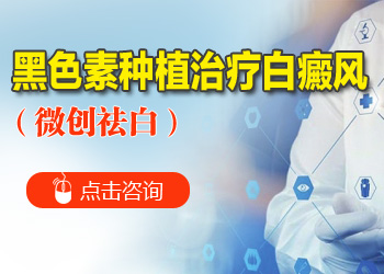 出现手部白癜风症状的缘由是什么