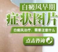308准分子激光吧