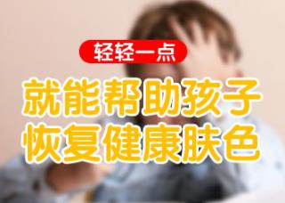 308治疗白癜疯效果