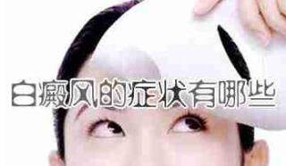 308激光治疗早期的白癜风治好要花几钱