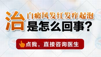 白癜风照射308激光后有一点痒正常吗