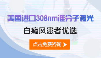 进口308纳米治疗仪治白癜风效果怎么样