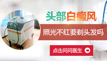 头皮有白癜风用不用剃头